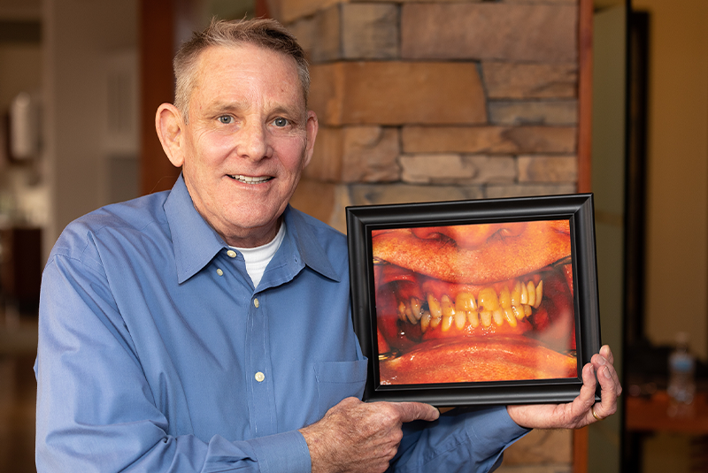 Dr. Vanstrom's patient holding their before photo and smiling